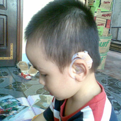 máy trợ thính tốt cho trẻ
